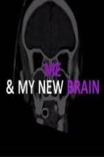 Me & My New Brain ( 2015 )