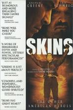 Skins (2002)