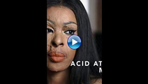 Acid Attack: My Story (2018)