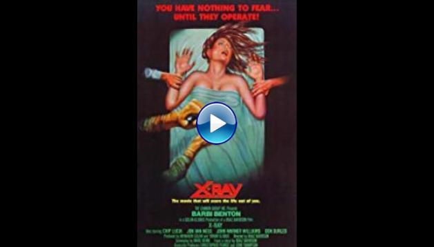 X-Ray (1981)