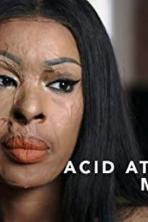 Acid Attack: My Story (2018)